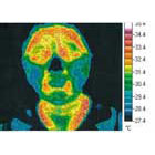 Thermography-Test