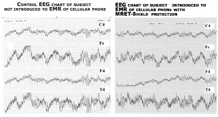 EEG Test Results