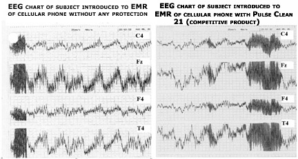 EEG Test Results