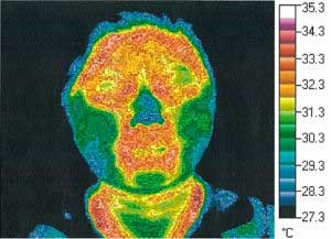 Thermography Test 1