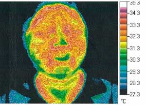 Thermography Test 2