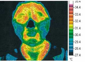 Thermography Test 3