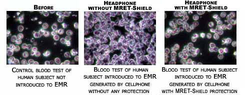 Live Blood Cell Analysis